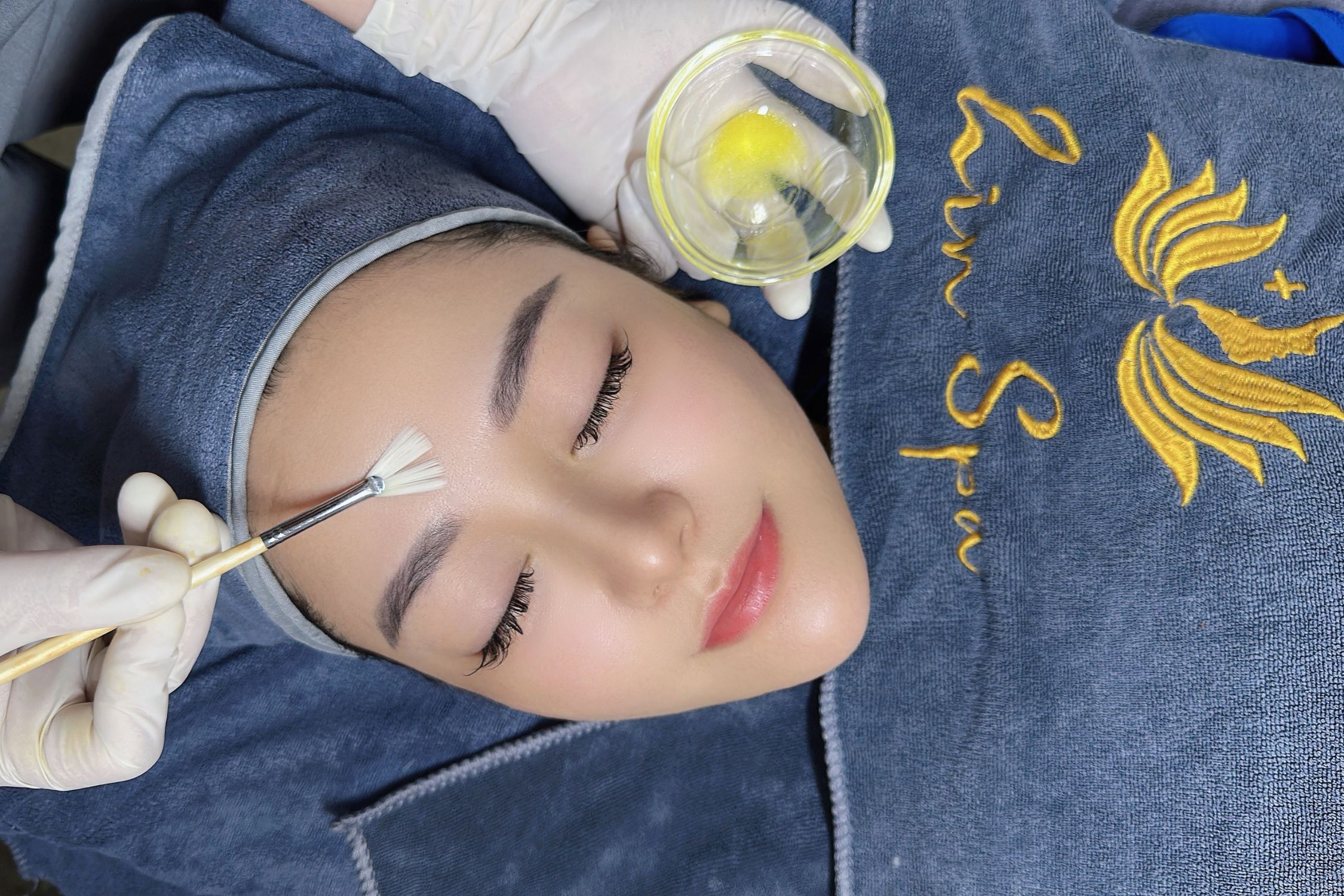 Peel da chuyên sâu tại Zin Spa